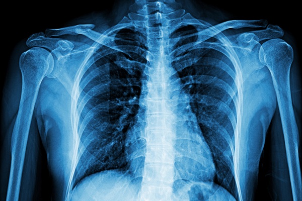 Skeleton x-ray back and shoulders
